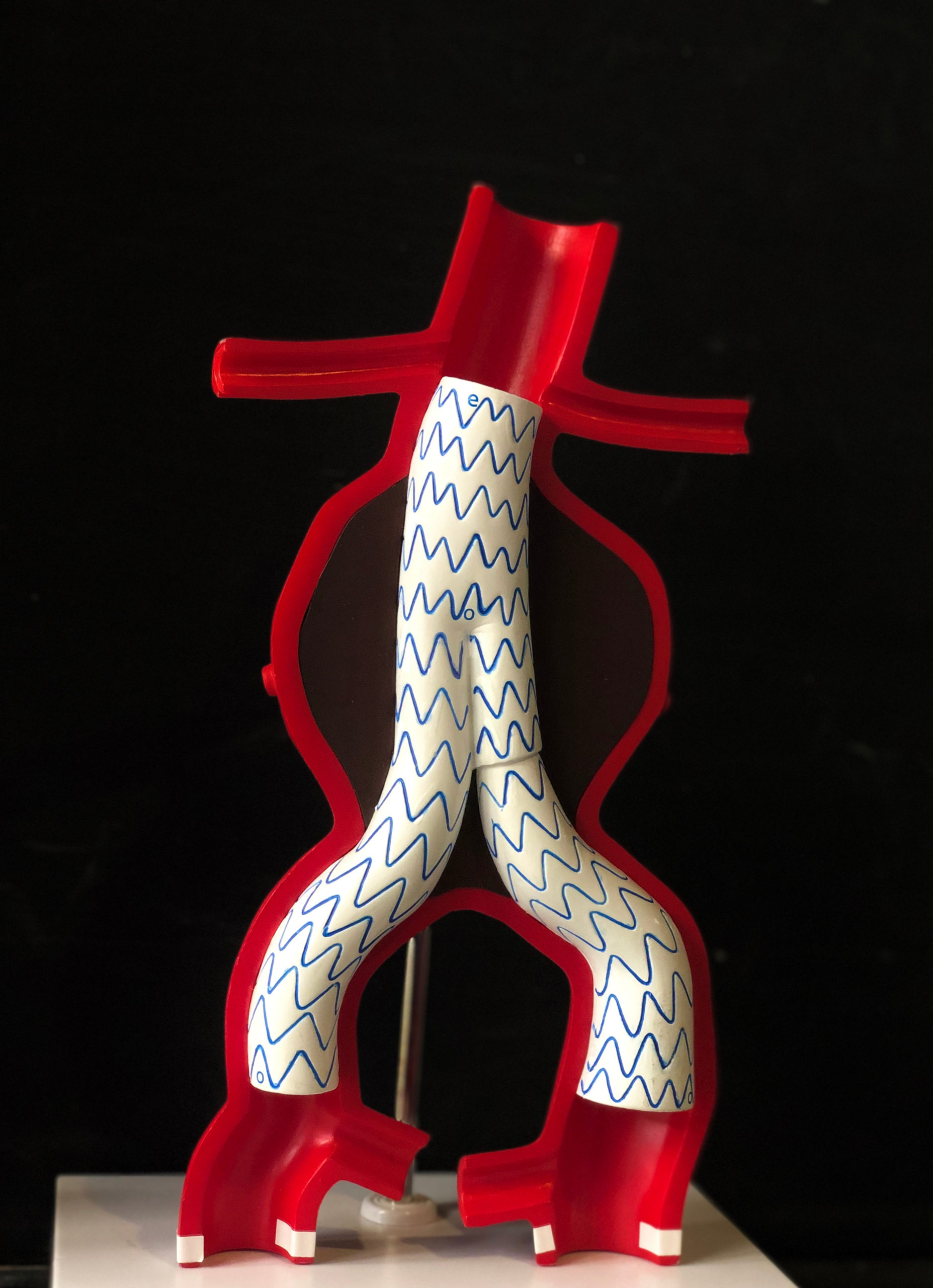 專訪 EP15 主動脈剝離容易發生在瘦瘦高高的男生？急性冠心症究竟是什麼？就是我們俗稱的心肌梗塞啦！ Feat.林茂欣