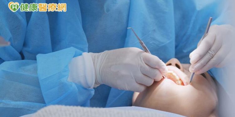 洗牙提早發現牙周、蛀牙問題　你有多久沒有洗牙了？