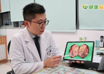 如何評估肝癌治療？　醫籲尋求第二意見
