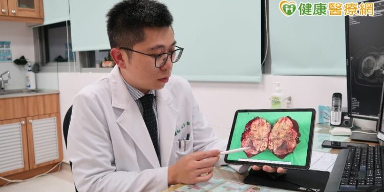 如何評估肝癌治療？　醫籲尋求第二意見