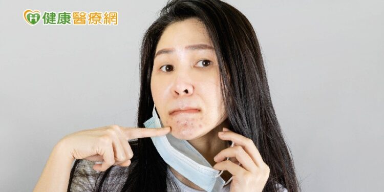 青春過後留下痘疤 皮膚科醫師解析完全攻略