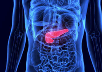 癌王又發威！ 胰臟癌9成患者一年就喪命