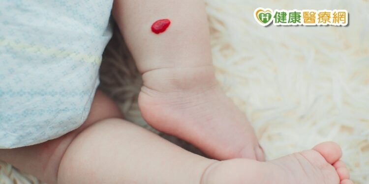 嬰兒血管瘤超醒目 治不治療怎麼判斷?