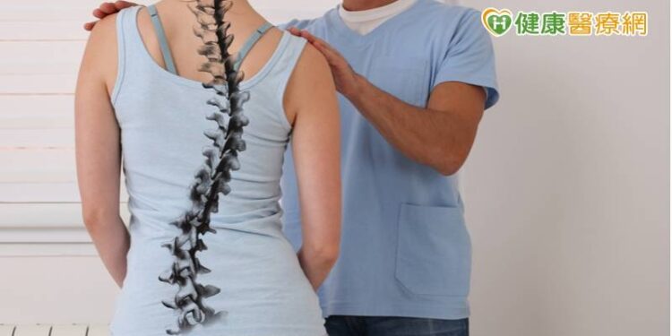 肩膀一高一低當心是脊椎側彎！-醫警告：嚴重一年彎10度