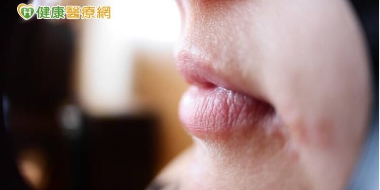 布魯斯威利罹失語症宣布息影-　什麼是失語症？