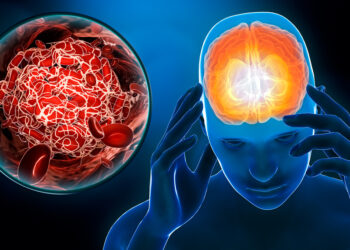 把握黃金3小時！有效預防腦中風