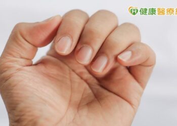確診除了咳嗽、發燒　「新冠指甲」也是症狀之一！