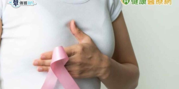乳癌年輕化趨勢!醫籲「篩檢重要性」