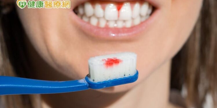 年輕人刷牙流血藏危機！恐是「青年型牙周病」