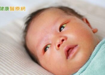 新生兒滿月仍有黃疸　當心「膽道閉鎖症」上身