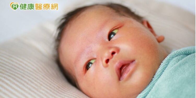 新生兒滿月仍有黃疸　當心「膽道閉鎖症」上身