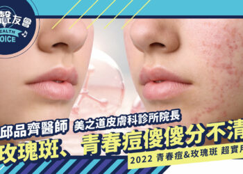 玫瑰斑