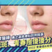 玫瑰斑