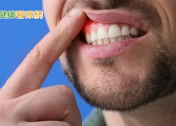 沒有牙痛卻患牙周病？　醫直指「關鍵原因」：當心會遺傳
