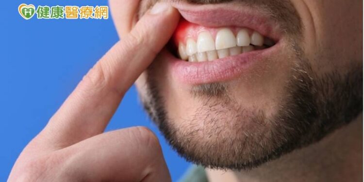 沒有牙痛卻患牙周病? 醫直指「關鍵原因」:當心會遺傳