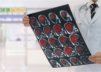 龍巖總裁李世聰病逝享壽65歲　凸顯腦瘤危險性！
