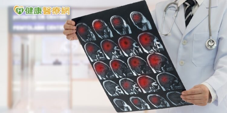 龍巖總裁李世聰病逝享壽65歲 凸顯腦瘤危險性!