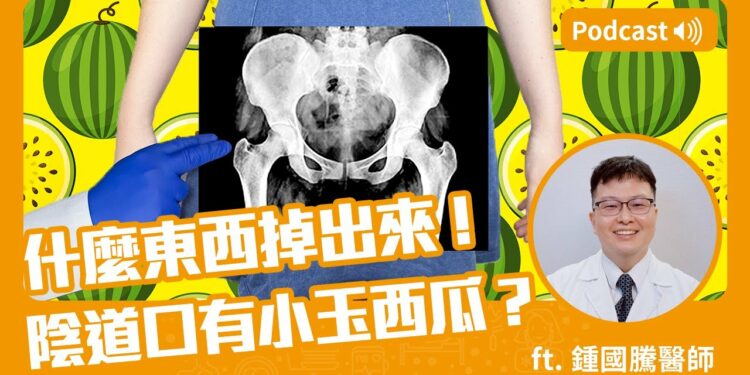 什麼東西掉出來😳？陰道口有小玉西瓜😱！Feat.鍾國騰醫師