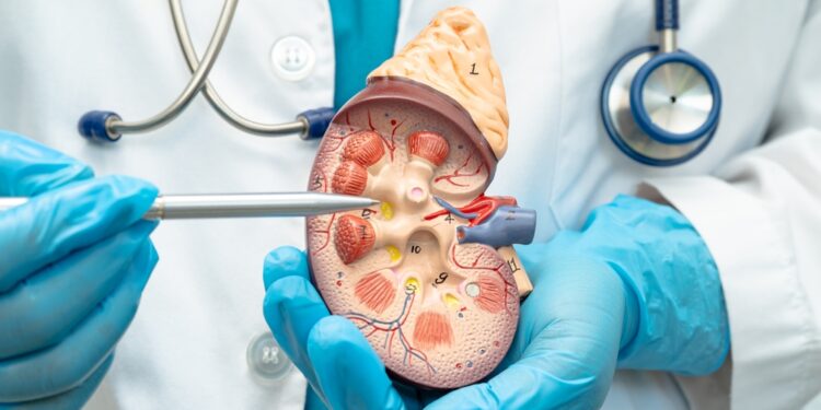 打破「無藥可醫」的宿命：Jinarc 成為全球首款核准治療 ADPKD 的藥物